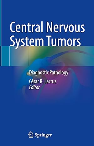 Seller image for Central Nervous System Tumors for sale by moluna