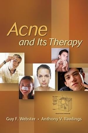 Seller image for Acne and Its Therapy: 40 (Basic and Clinical Dermatology) for sale by WeBuyBooks