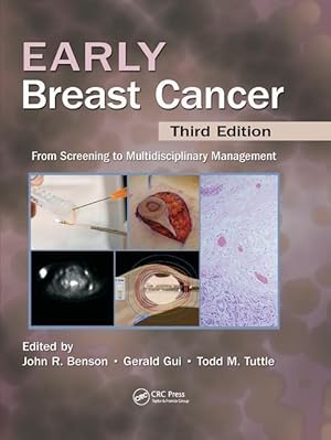 Image du vendeur pour Early Breast Cancer mis en vente par moluna