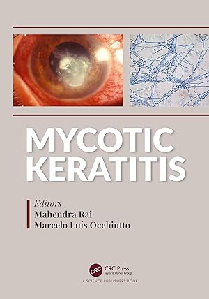 Seller image for Mycotic Keratitis for sale by moluna