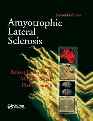 Seller image for Amyotrophic Lateral Sclerosis, Second Edition for sale by moluna