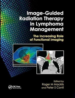 Seller image for Image-Guided Radiation Therapy in Lymphoma Management for sale by moluna