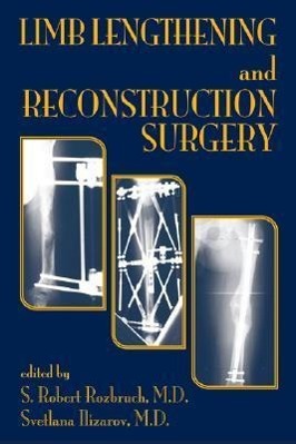 Immagine del venditore per Limb Lengthening and Reconstruction Surgery venduto da moluna