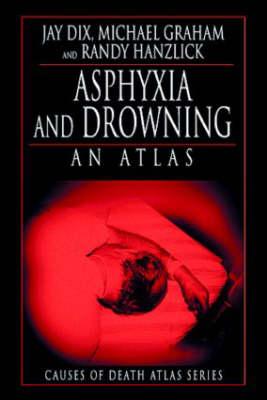 Seller image for Dix, J: Asphyxia and Drowning for sale by moluna