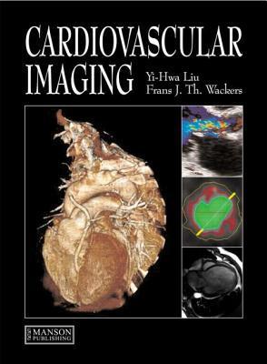 Seller image for Cardiovascular Imaging for sale by moluna