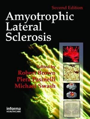 Seller image for Amyotrophic Lateral Sclerosis, Second Edition for sale by moluna