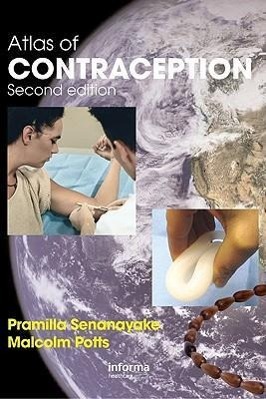 Seller image for Atlas of Contraception for sale by moluna