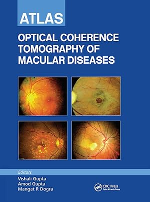 Bild des Verkufers fr Atlas of Optical Coherence Tomography of Macular Diseases zum Verkauf von moluna