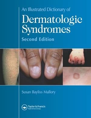 Image du vendeur pour An Illustrated Dictionary of Dermatologic Syndromes mis en vente par moluna