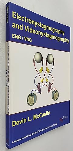 Electronystamography/Videonystagmography (Core Clinical Concepts in Audiology)