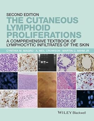 Bild des Verkufers fr The Cutaneous Lymphoid Proliferations: A Comprehensive Textbook of Lymphocytic Infiltrates of the Skin zum Verkauf von Studibuch