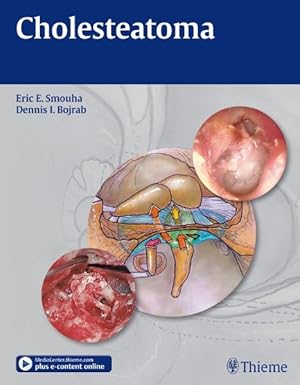 Imagen del vendedor de Cholesteatoma: Surgical Decision Making, Issues, and Controversies. With E-Book a la venta por Studibuch