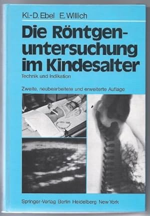 Bild des Verkufers fr Die Rntgenuntersuchung im Kindesalter. Technik und Indikation. Unter Bercksichtigung der Nuklearmedizin und der kranialen Computertomographie. zum Verkauf von Antiquariat Bcherstapel