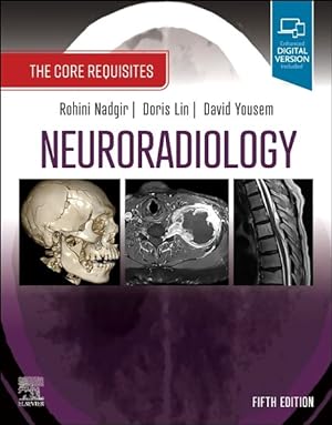 Image du vendeur pour Neuroradiology : The Core Requisites mis en vente par GreatBookPrices