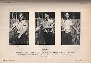 Seller image for L'Encphale journal de neurologie et de psychiatrie fonde par A. Antheaume, publi et dirig par Henri Claude & Jean Lhermitte 1925 (vingtime anne) tome 20 premier semestre for sale by LIBRAIRIE PIMLICO