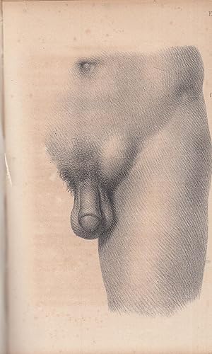 Image du vendeur pour De la Cure radicale des hernies, par le Dr Jalade-Lafond, . 23e dition . mis en vente par LIBRAIRIE PIMLICO
