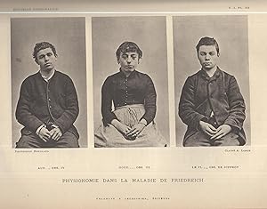 Bild des Verkufers fr Nouvelle Iconographie De La Salptrire Tome I n 2 mars et avril 1888 zum Verkauf von LIBRAIRIE PIMLICO