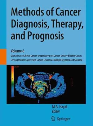 Immagine del venditore per Methods of Cancer Diagnosis, Therapy, and Prognosis : Ovarian Cancer, Renal Cancer, Urogenitary Tract Cancer, Urinary Bladder Cancer, Cervical Uterine Cancer, Skin Cancer, Leukemia, Multiple Myeloma, and Sarcoma venduto da GreatBookPrices