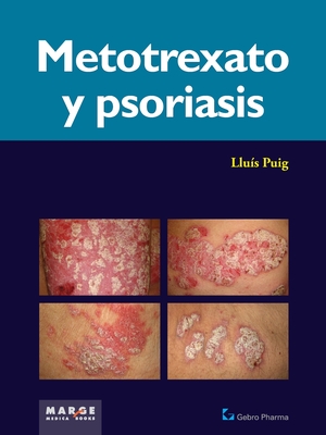 Imagen del vendedor de Metotrexato y psoriaris (Paperback or Softback) a la venta por BargainBookStores