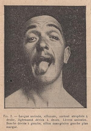 Image du vendeur pour Revue Neurologique janvier 1917 (exemplaire de Pierre Janet) mis en vente par LIBRAIRIE PIMLICO