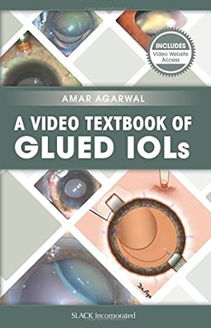 Seller image for A Video Textbook of Glued Iols for sale by WeBuyBooks