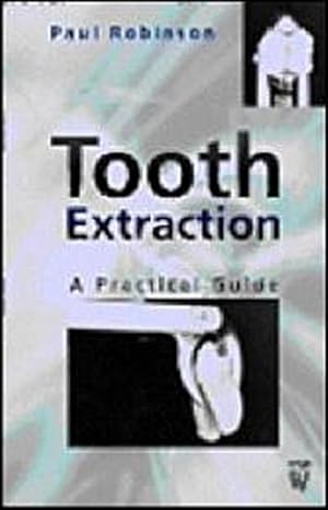 Bild des Verkufers fr Tooth Extraction : A Practical Guide zum Verkauf von AHA-BUCH GmbH