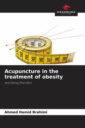 Bild des Verkufers fr Acupuncture in the treatment of obesity zum Verkauf von moluna
