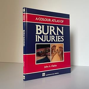 Bild des Verkufers fr A Colour Atlas Of Burn Injuries zum Verkauf von Riveting Books