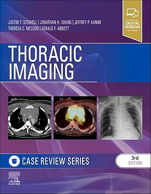 Bild des Verkufers fr Thoracic Imaging: Case Review zum Verkauf von moluna