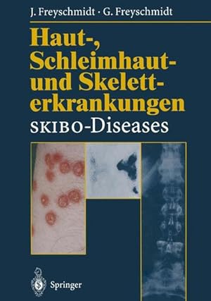 Seller image for Haut-, Schleimhaut- und Skeletterkrankungen SKIBO-Diseases: Eine dermatologische-klinisch-radiologische Synopse for sale by Studibuch