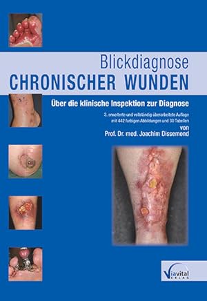 Bild des Verkufers fr Blickdiagnose chronischer Wunden: ber die klinische Inspektion zur Diagnose zum Verkauf von Studibuch