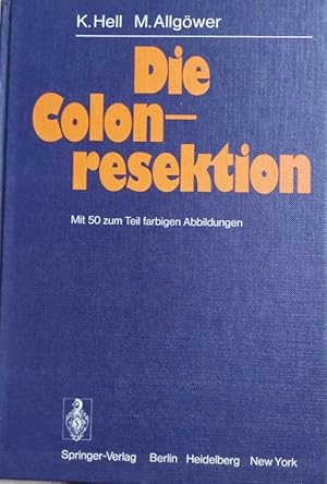 Die Colonresektion Mit 50 zum Teil farbigen Abbildungen