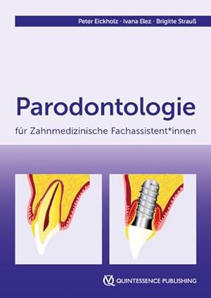 Seller image for Parodontologie fr Zahnmedizinische Fachassistent\*innen for sale by Rheinberg-Buch Andreas Meier eK