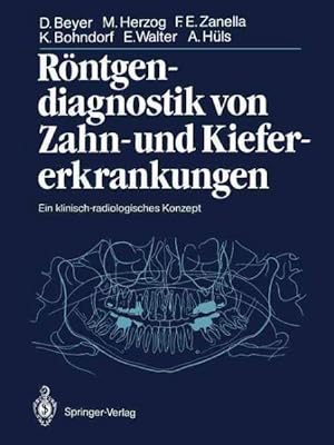Seller image for Rontgendiagnostik Von Zahn- Und Kiefererkrankungen : Ein Klinischradiologisches Konzept -Language: German for sale by GreatBookPrices