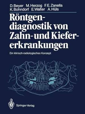 Bild des Verkufers fr Rontgendiagnostik Von Zahn- Und Kiefererkrankungen : Ein Klinischradiologisches Konzept -Language: German zum Verkauf von GreatBookPrices