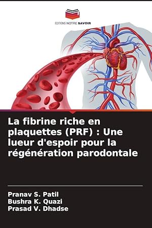 Bild des Verkufers fr La fibrine riche en plaquettes (PRF) : Une lueur d espoir pour la rgnration parodontale zum Verkauf von moluna