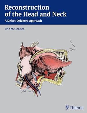 Seller image for Reconstruction of the Head and Neck: A Defect-Oriented Approach for sale by Studibuch