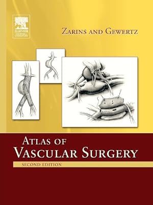Seller image for Atlas of Vascular Surgery for sale by GreatBookPrices