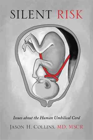 Bild des Verkufers fr Silent Risk : Issues About the Human Umbilical Cord zum Verkauf von GreatBookPrices