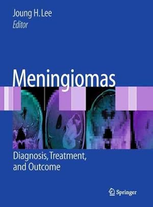 Seller image for Meningiomas : Diagnosis, Treatment and Outcome for sale by GreatBookPrices