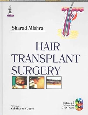 Seller image for Hair Transplant Surgery for sale by GreatBookPricesUK