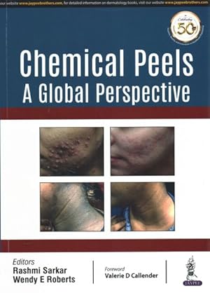 Seller image for Chemical Peels : A Global Perspective for sale by GreatBookPrices