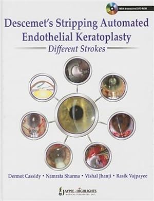 Bild des Verkufers fr Descemet's Stripping Automated Endothelial Keratoplasty Different Strokes zum Verkauf von GreatBookPrices