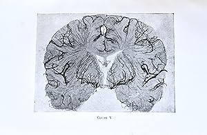 Etude radiographique des artères du cerveau.