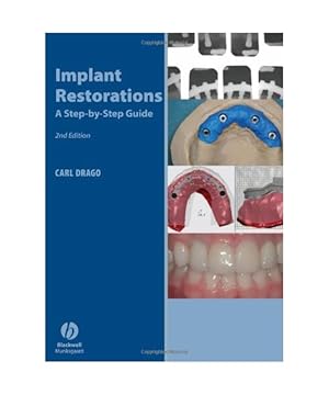 Bild des Verkufers fr Implant Restorations: A Step-By-Step Guide zum Verkauf von Buchpark