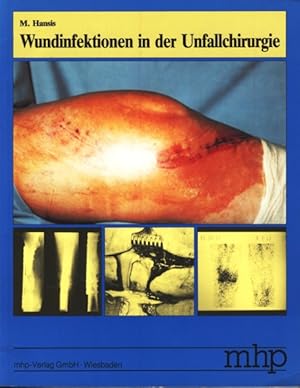 Seller image for Wundinfektionen in der Unfallchirurgie ;. for sale by TF-Versandhandel - Preise inkl. MwSt.