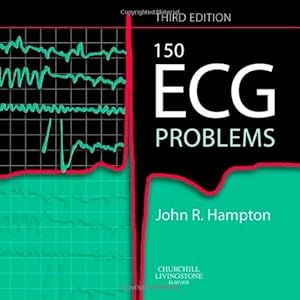Bild des Verkufers fr 150 ECG Problems, 3e|150 Ecg Problems|150 Ecg Problems|150 Ecg Problems zum Verkauf von WeBuyBooks
