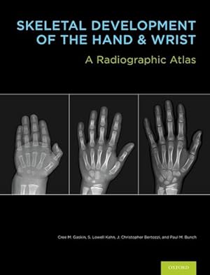 Immagine del venditore per Skeletal Development of the Hand and Wrist : A Radiographic Atlas and Digital Bone Age Companion venduto da GreatBookPricesUK