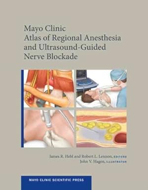 Seller image for Mayo Clinic Atlas of Regional Anesthesia and Ultrasound-Guided Nerve Blockade for sale by GreatBookPrices
