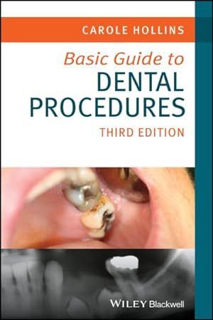 Seller image for Basic Guide to Dental Procedures for sale by GreatBookPrices